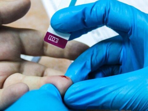 Более 2 млн жителей Подмосковья прошли тестирование на наличие ВИЧ-инфекции с начала года | Новости Московской области | Новости Подмосковья 