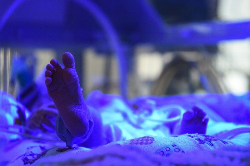 Более 200 новорожденных с экстремально низкой массой тела спасли в Подмосковье с начала года | Новости Московской области | Подмосковья 