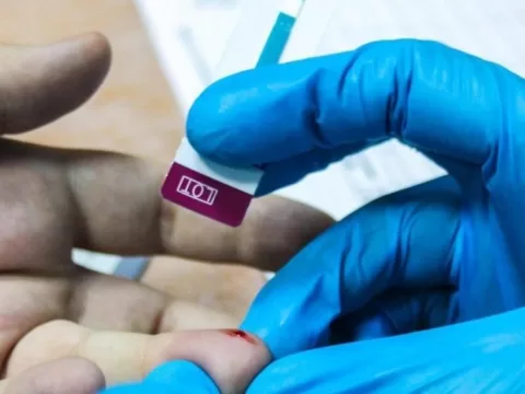 Тестирование на ВИЧ-инфекцию прошли в Подмосковье более 2 млн человек за 2022 год | Новости Московской области | Новости Подмосковья 