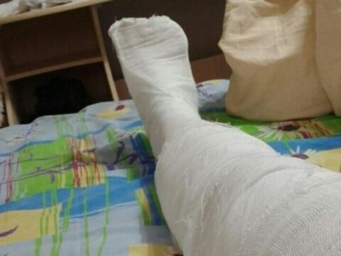 В Московской области бизнесмена ограбили и сломали ему ногу | Новости Московской области | Новости Подмосковья 